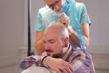 Scalp Micropigmentation